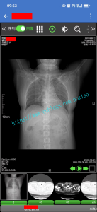 基于SaaS纯BS架构的全院级云PACS系统-牛翰网